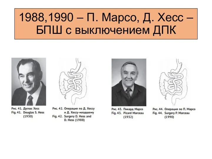1988,1990 – П. Марсо, Д. Хесс – БПШ с выключением ДПК