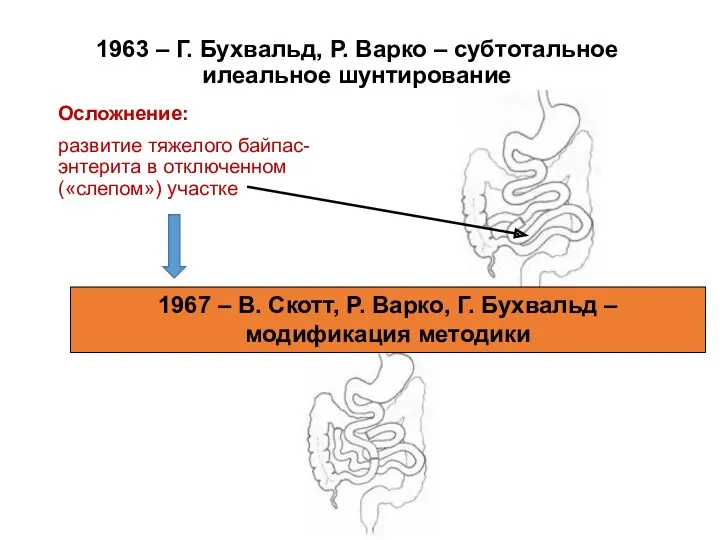 1963 – Г. Бухвальд, Р. Варко – субтотальное илеальное шунтирование