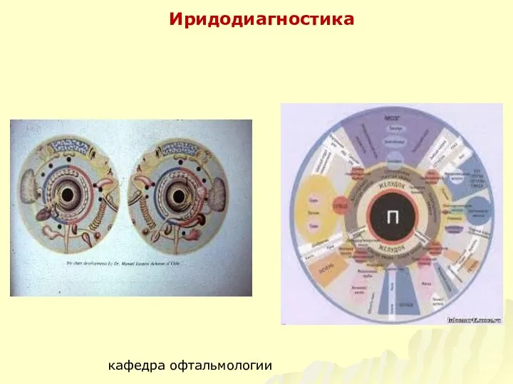 Иридодиагностика кафедра офтальмологии