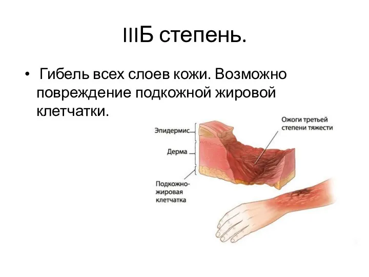 IIIБ степень. Гибель всех слоев кожи. Возможно повреждение подкожной жировой клетчатки.