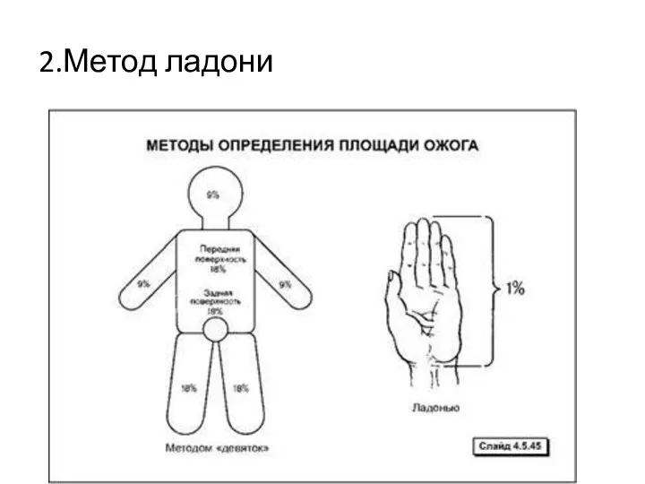 2.Метод ладони