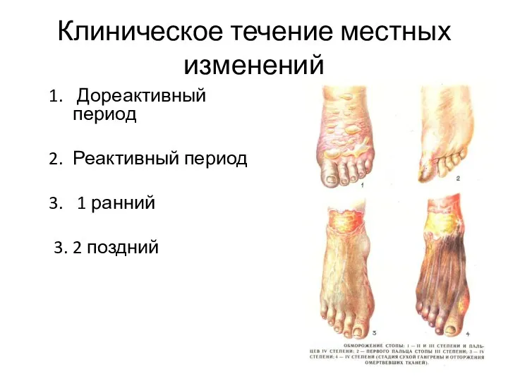 Клиническое течение местных изменений Дореактивный период Реактивный период 1 ранний 3. 2 поздний