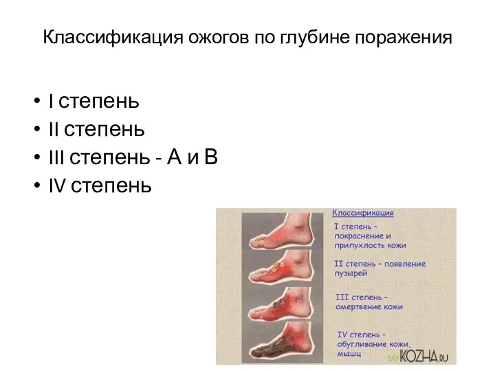 Классификация ожогов по глубине поражения I степень II степень III