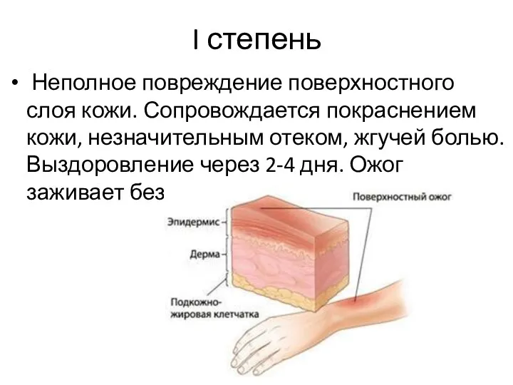 I степень Неполное повреждение поверхностного слоя кожи. Сопровождается покраснением кожи,