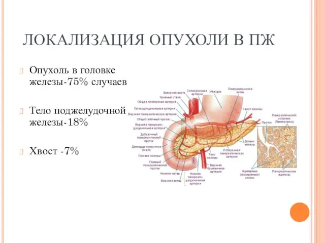 ЛОКАЛИЗАЦИЯ ОПУХОЛИ В ПЖ Опухоль в головке железы-75% случаев Тело поджелудочной железы-18% Хвост -7%