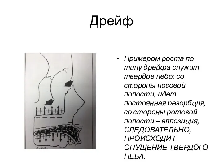 Дрейф Примером роста по типу дрейфа служит твердое небо: со