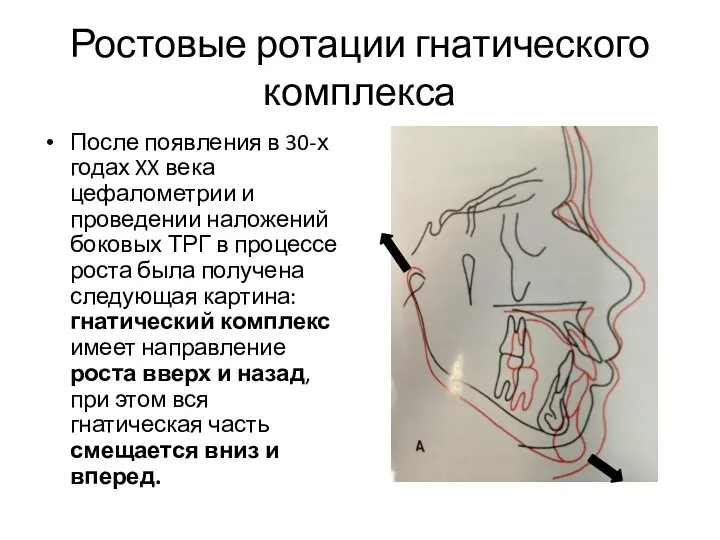 Ростовые ротации гнатического комплекса После появления в 30-х годах XX