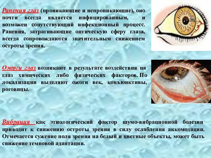 Ранения глаз (проникающие и непроникающие), оно почти всегда является инфицированным,