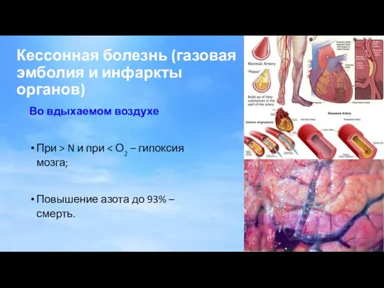 Кессонная болезнь (газовая эмболия и инфаркты органов) Во вдыхаемом воздухе При > N
