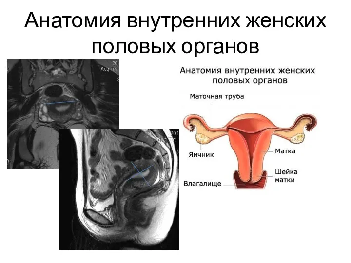 Анатомия внутренних женских половых органов