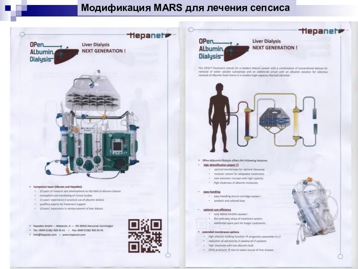 Модификация MARS для лечения сепсиса