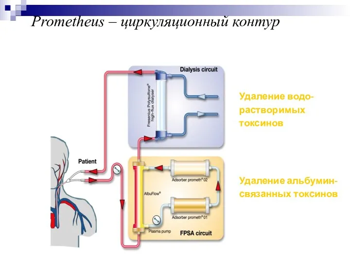 Удаление водо-растворимых токсинов Удаление альбумин-связанных токсинов Prometheus – циркуляционный контур