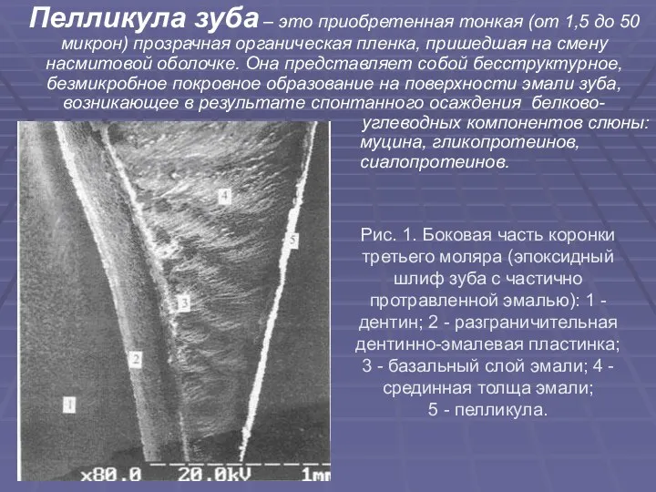 Пелликула зуба – это приобретенная тонкая (от 1,5 до 50