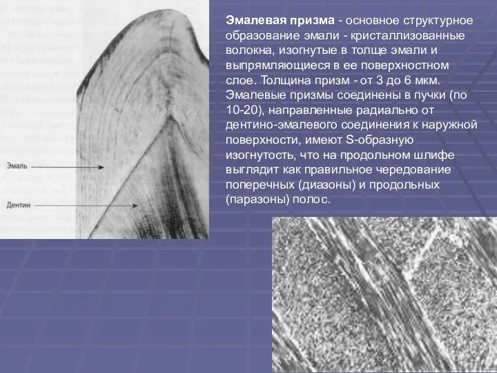 Эмалевая призма - основное структурное образование эмали - кристаллизованные волокна,