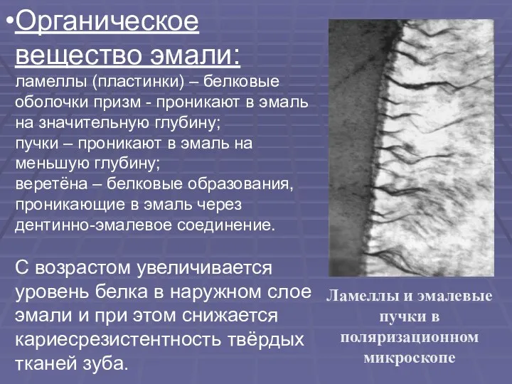 Ламеллы и эмалевые пучки в поляризационном микроскопе Органическое вещество эмали: