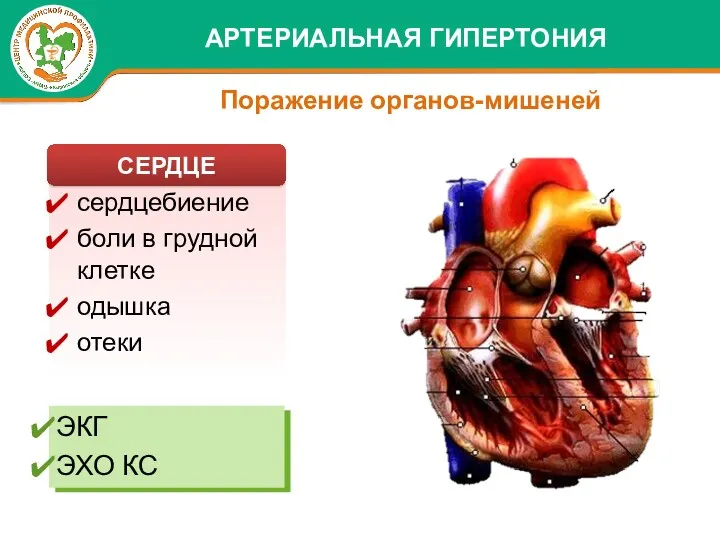 сердцебиение боли в грудной клетке одышка отеки ЭКГ ЭХО КС АРТЕРИАЛЬНАЯ ГИПЕРТОНИЯ Поражение органов-мишеней СЕРДЦЕ