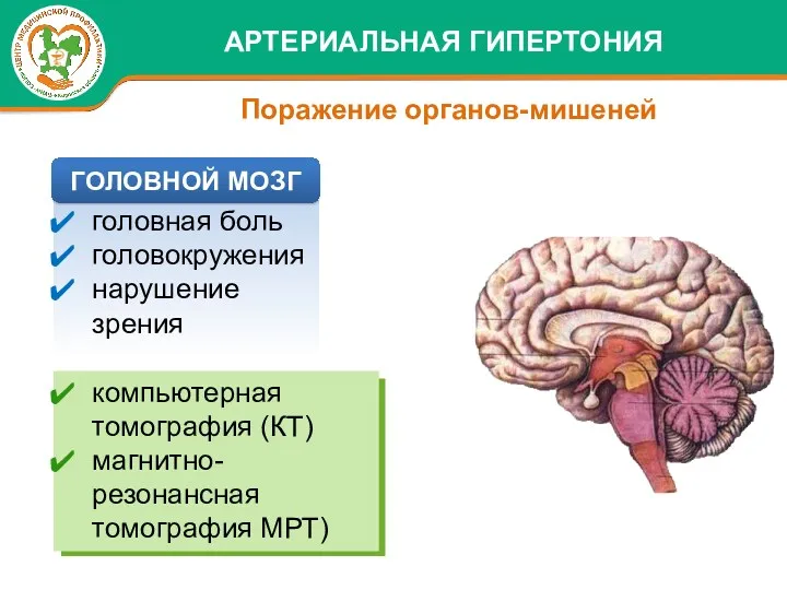 головная боль головокружения нарушение зрения компьютерная томография (КТ) магнитно-резонансная томография МРТ) АРТЕРИАЛЬНАЯ ГИПЕРТОНИЯ