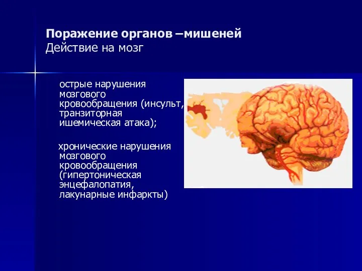 Поражение органов –мишеней Действие на мозг острые нарушения мозгового кровообращения (инсульт, транзиторная ишемическая