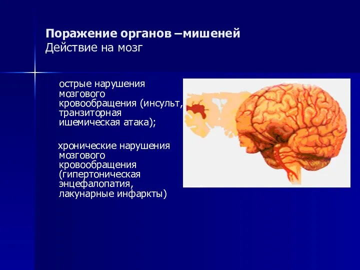 Поражение органов –мишеней Действие на мозг острые нарушения мозгового кровообращения