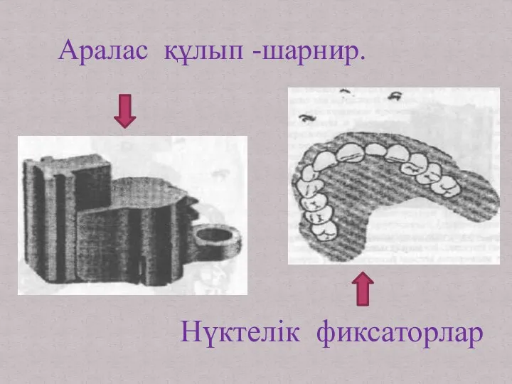 Аралас құлып -шарнир. Нүктелік фиксаторлар