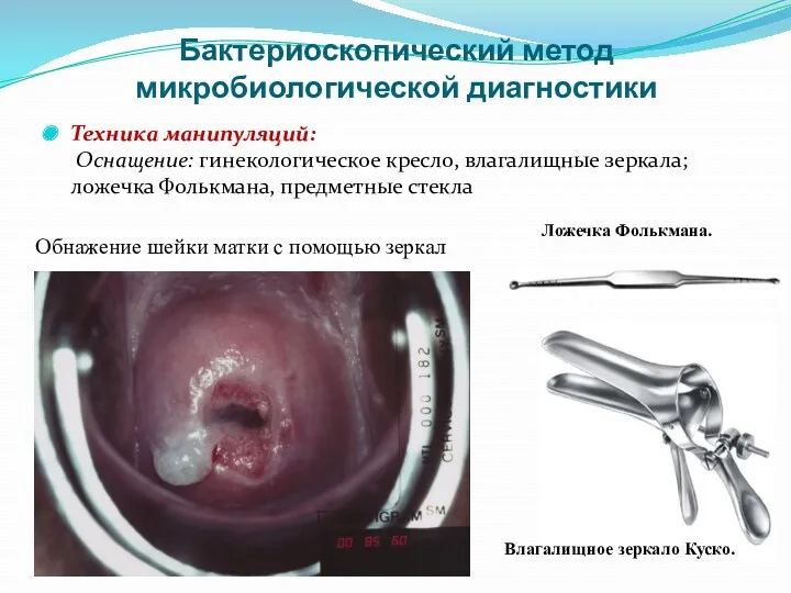 Бактериоскопический метод микробиологической диагностики Техника манипуляций: Оснащение: гинекологическое кресло, влагалищные