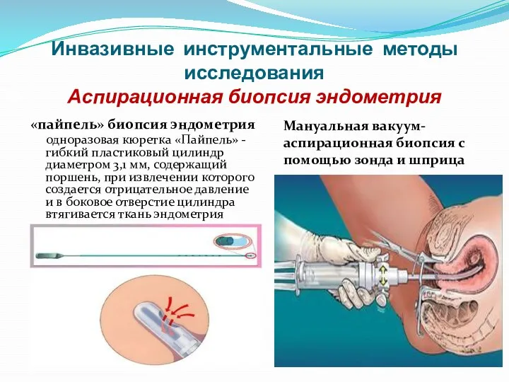 Инвазивные инструментальные методы исследования Аспирационная биопсия эндометрия «пайпель» биопсия эндометрия