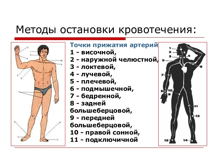 Методы остановки кровотечения: Точки прижатия артерий: 1 - височной, 2