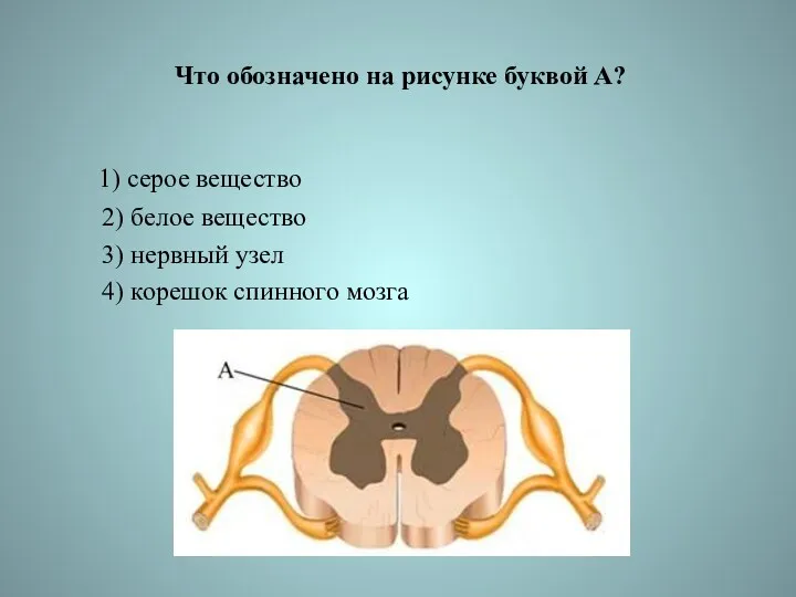 Что обозначено на рисунке буквой А? 1) серое вещество 2)