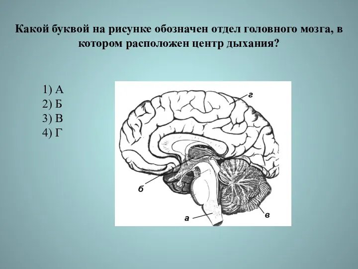 Какой буквой на рисунке обозначен отдел головного мозга, в котором