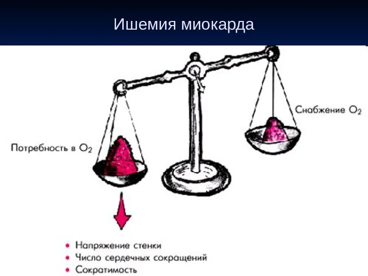 Ишемия миокарда ● обусловлена острым или хроническим несоответствием потребности миокарда