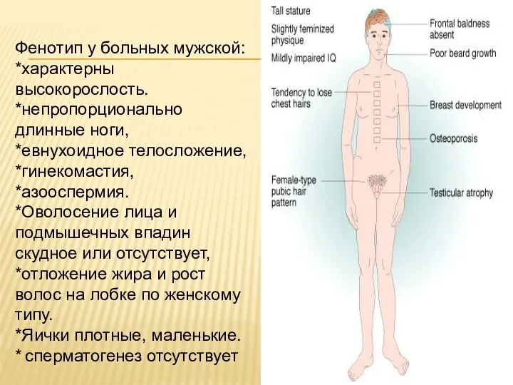 Фенотип у больных мужской: *характерны высокорослость. *непропорционально длинные ноги, *евнухоидное