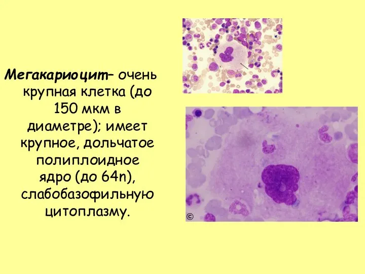 Мегакариоцит – очень крупная клетка (до 150 мкм в диаметре); имеет крупное, дольчатое