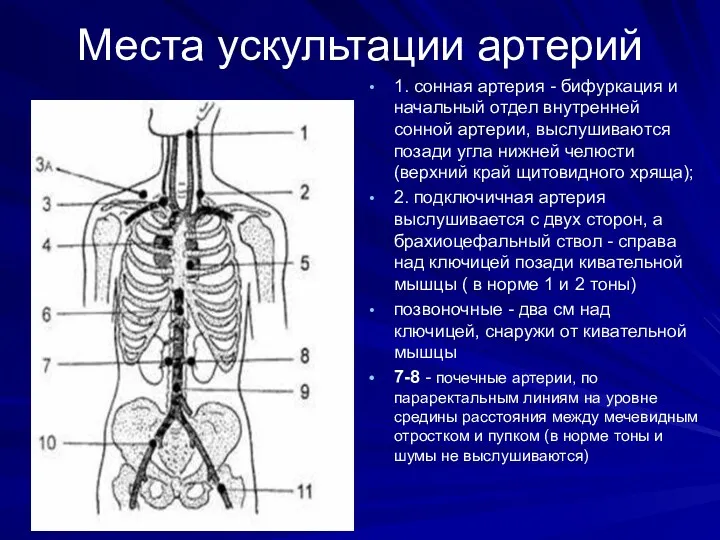 Места ускультации артерий 1. сонная артерия - бифуркация и начальный отдел внутренней сонной