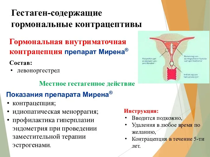 Гестаген-содержащие гормональные контрацептивы Гормональная внутриматочная контрацепция препарат Мирена® Состав: левоноргестрел Инструкция: Вводится подкожно,