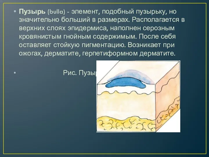 Пузырь (bulla) - элемент, подобный пузырьку, но значительно больший в