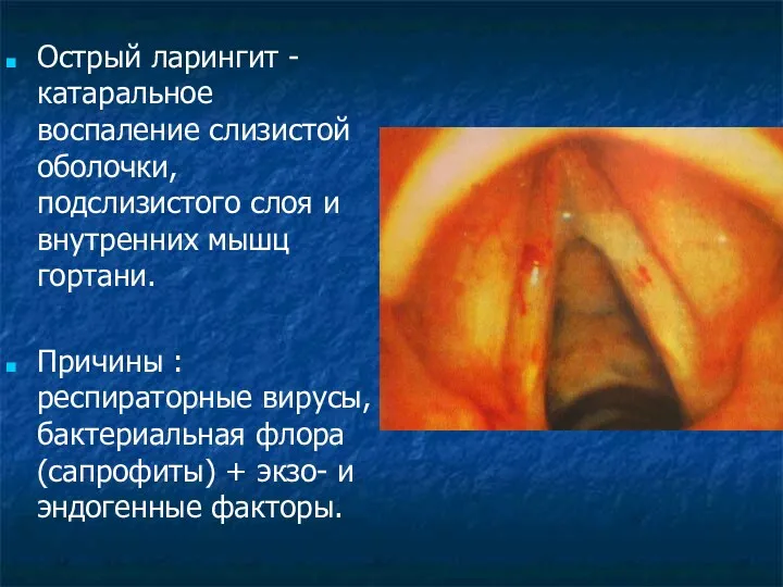 Острый ларингит - катаральное воспаление слизистой оболочки, подслизистого слоя и внутренних мышц гортани.
