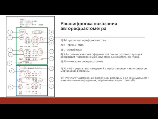 Расшифровка показания авторефрактометра 1) Ref - результаты рефрактометрии. 2) R