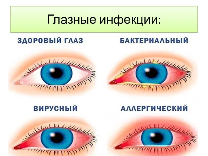 Глазные инфекции: Конъюктива – слизистая оболочка глаза.