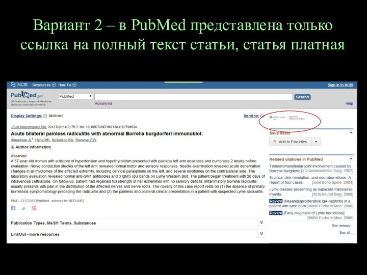 Вариант 2 – в PubMed представлена только ссылка на полный текст статьи, статья платная