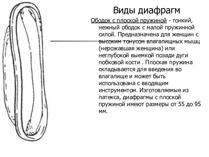 Виды диафрагм Ободок с плоской пружиной - тонкий, нежный ободок с малой пружинной