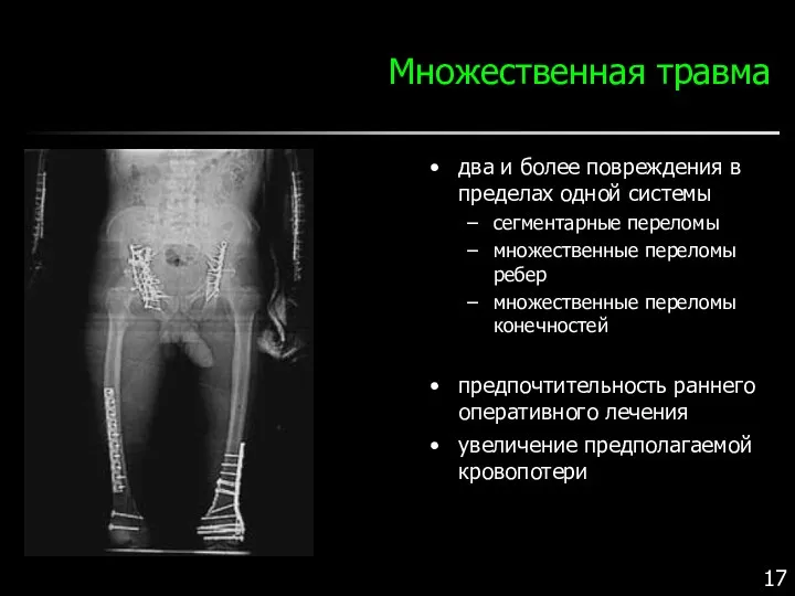 Множественная травма два и более повреждения в пределах одной системы