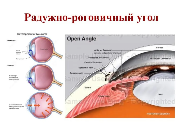 Радужно-роговичный угол