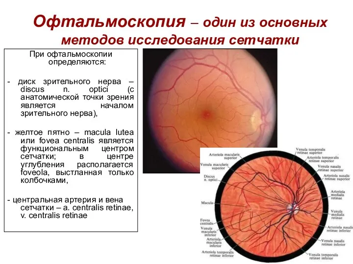 Офтальмоскопия – один из основных методов исследования сетчатки При офтальмоскопии определяются: - диск