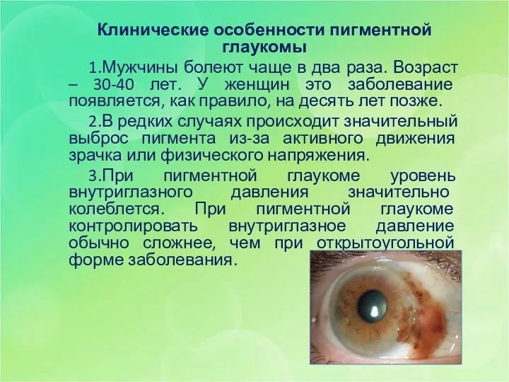 Клинические особенности пигментной глаукомы 1.Мужчины болеют чаще в два раза.