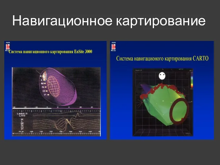 Навигационное картирование