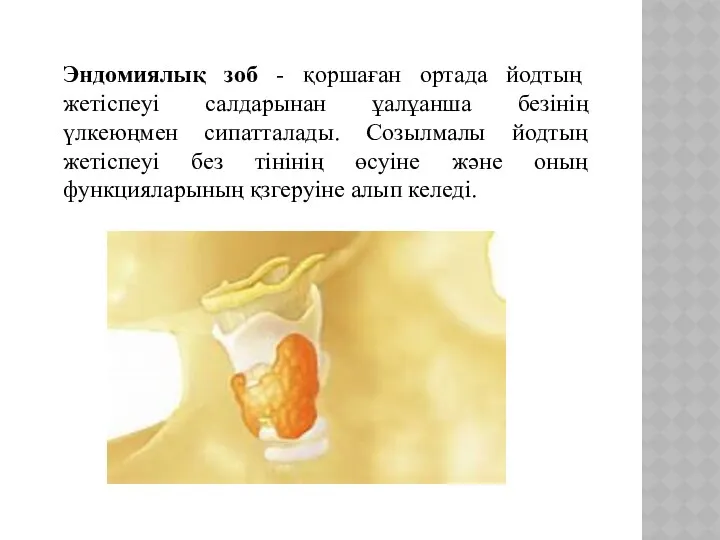 Эндомиялық зоб - қоршаған ортада йодтың жетіспеуі салдарынан ұалұанша безінің