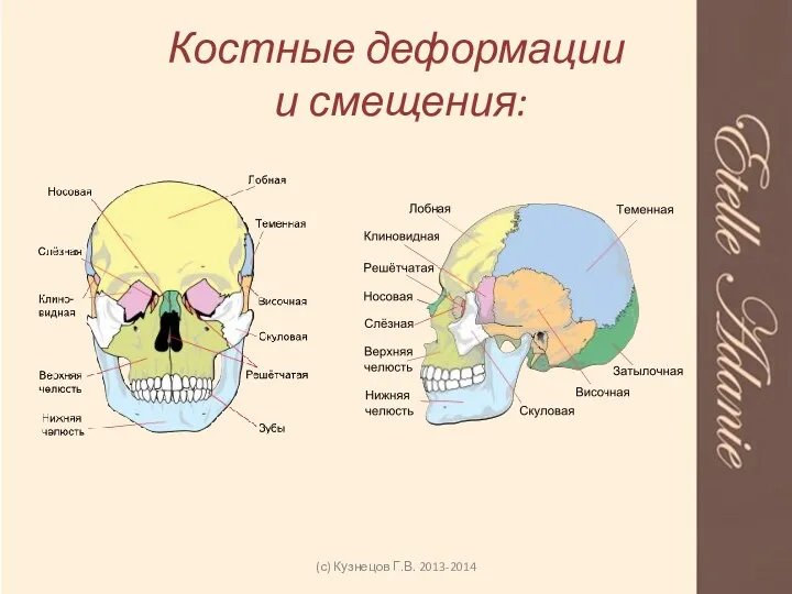 Костные деформации и смещения: (с) Кузнецов Г.В. 2013-2014