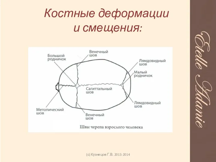 Костные деформации и смещения: (с) Кузнецов Г.В. 2013-2014