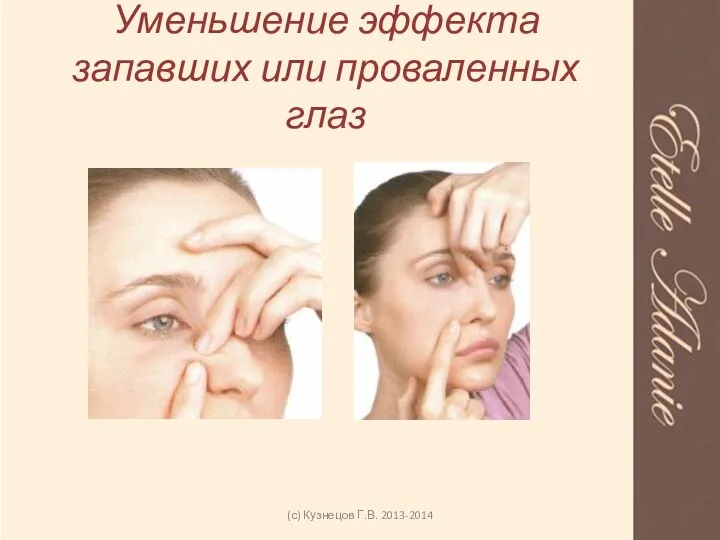 Уменьшение эффекта запавших или проваленных глаз (с) Кузнецов Г.В. 2013-2014