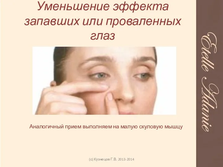 Уменьшение эффекта запавших или проваленных глаз (с) Кузнецов Г.В. 2013-2014 Аналогичный прием выполняем